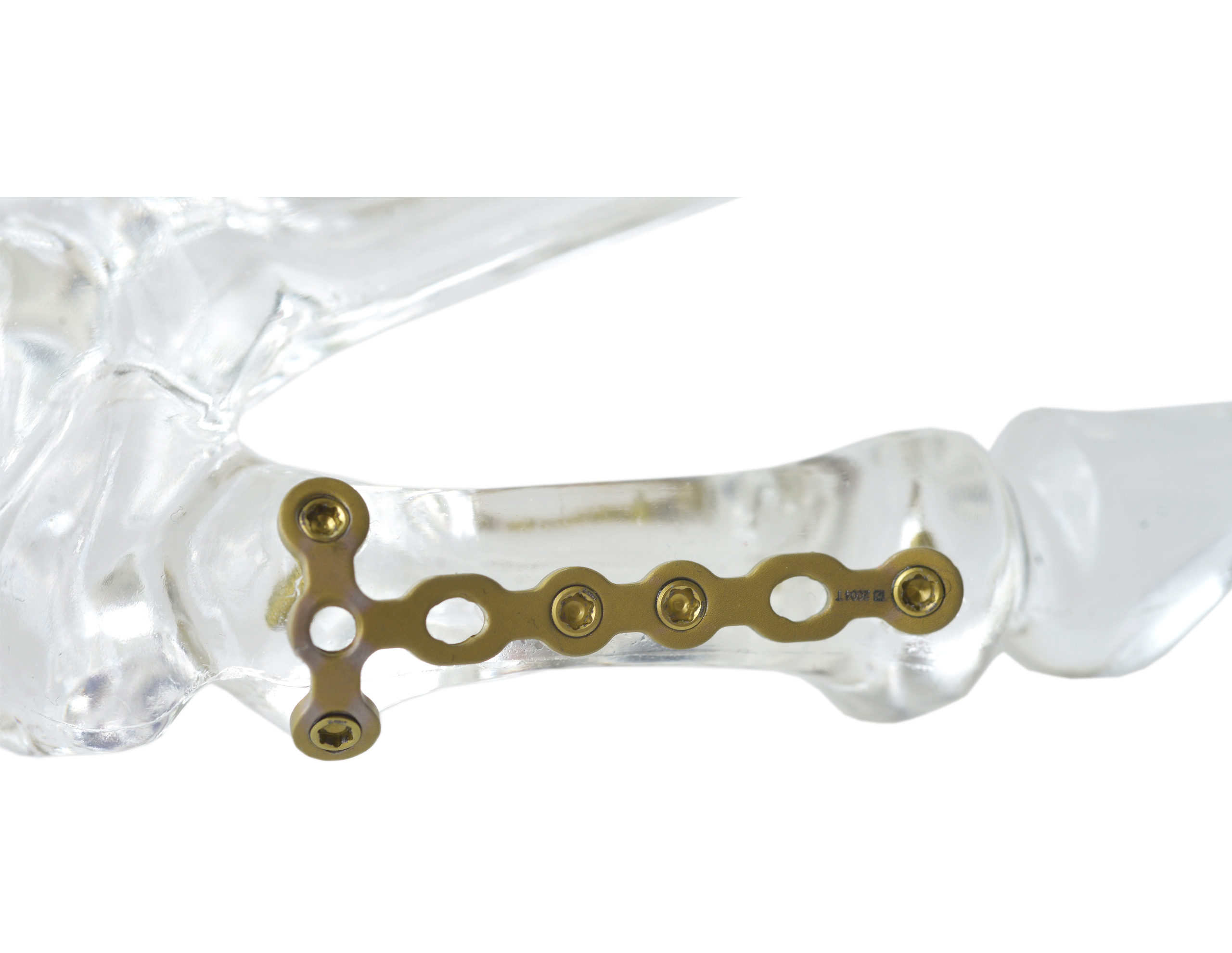 Vortex Hand & Foot lemezek - Image 4